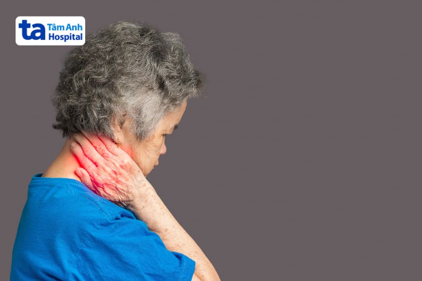 tổn thương dây thần kinh gây đau đầu arnold