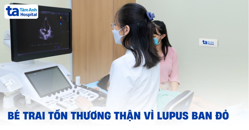 tổn thương thận vì lupus ban đỏ