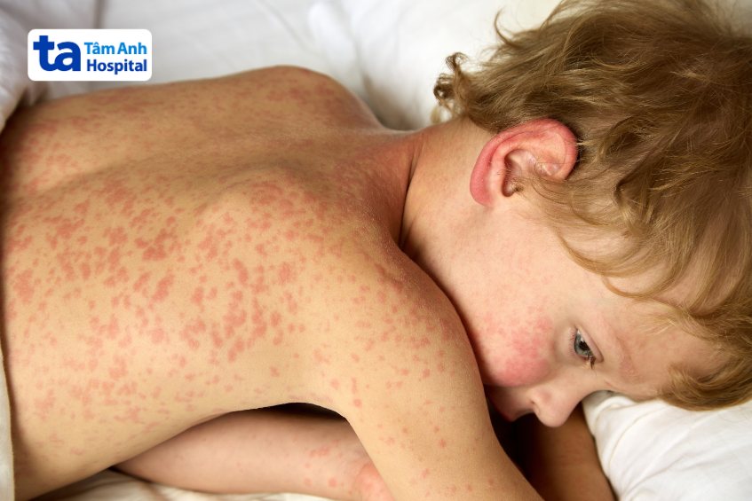 tránh gây hầm bí hoặc tổn thương