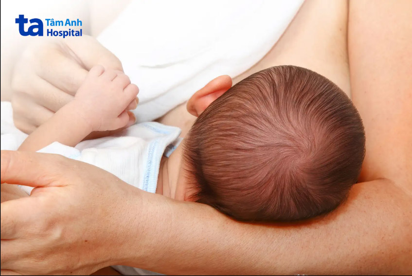 Trẻ bị dị ứng đạm bò nên bú mẹ để đảm bảo dinh dưỡng tốt hơn