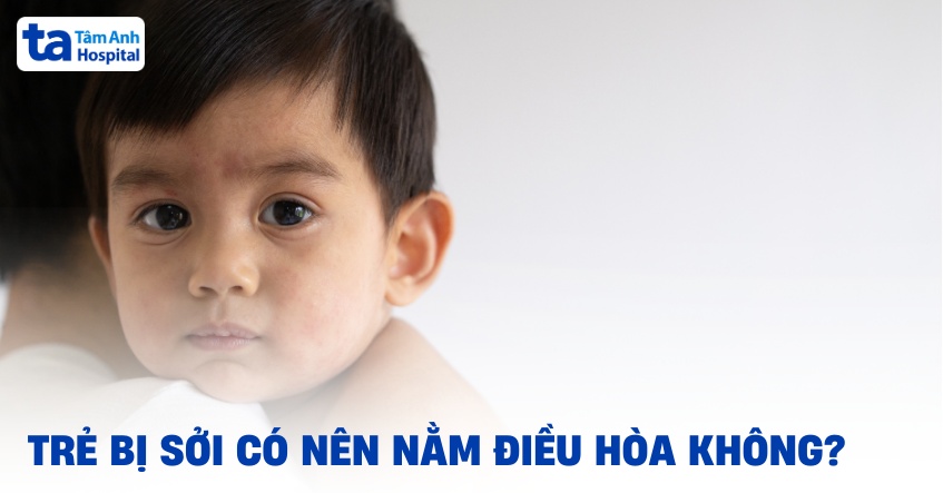Trẻ bị sởi có nên nằm điều hòa không? [Chuyên gia giải đáp]
