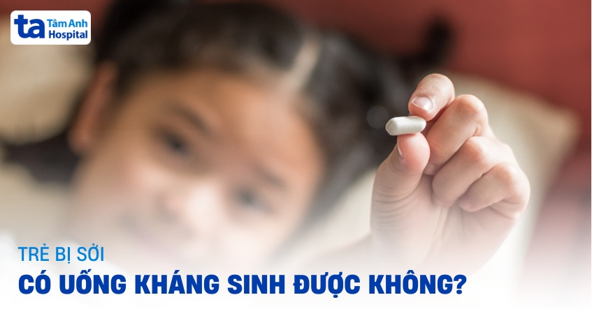 Trẻ bị sởi có uống kháng sinh được không? Cần lưu ý điều gì?
