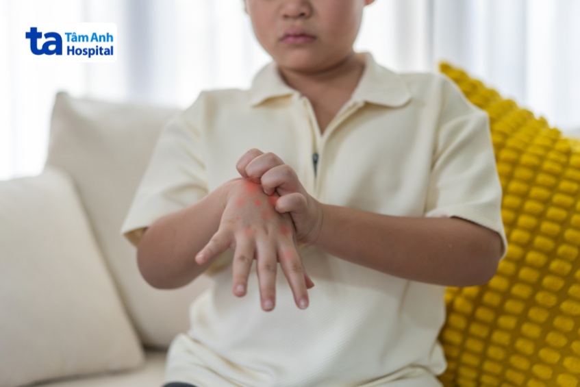 trẻ bị tay chân miệng có thể bị ngứa ngáy khó chịu