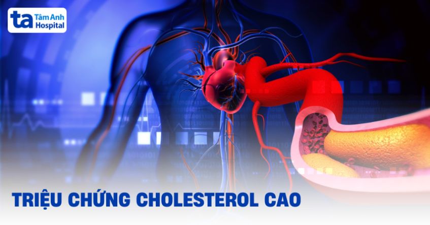 Các triệu chứng cholesterol cao cần biết để phòng ngừa sớm