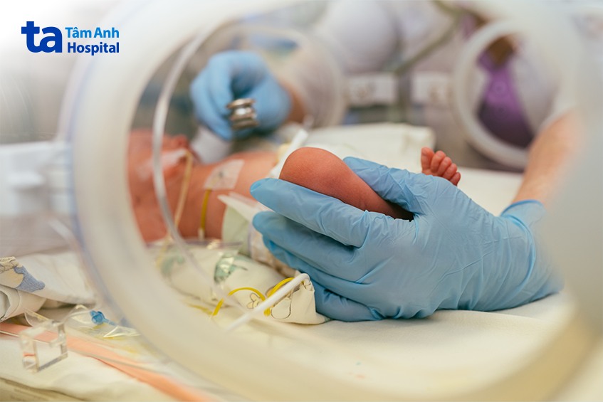 trước khi thực chiếu đèn điều trị vàng da ở trẻ sơ sinh