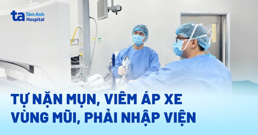 tự nặn mụn viêm áp xe mũi