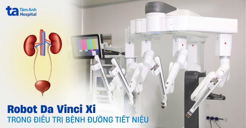 Ứng dụng Robot Da vinci Xi trong điều trị bệnh đường tiết niệu