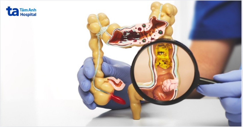 ứng dụng robot davinci xi trong y học