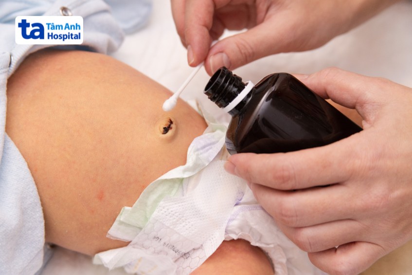vệ sinh rốn cho trẻ thường xuyên