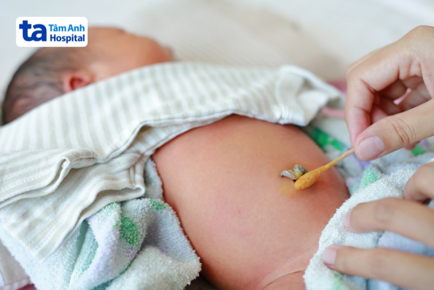 vệ sinh rốn đúng cách và cho trẻ dùng thuốc