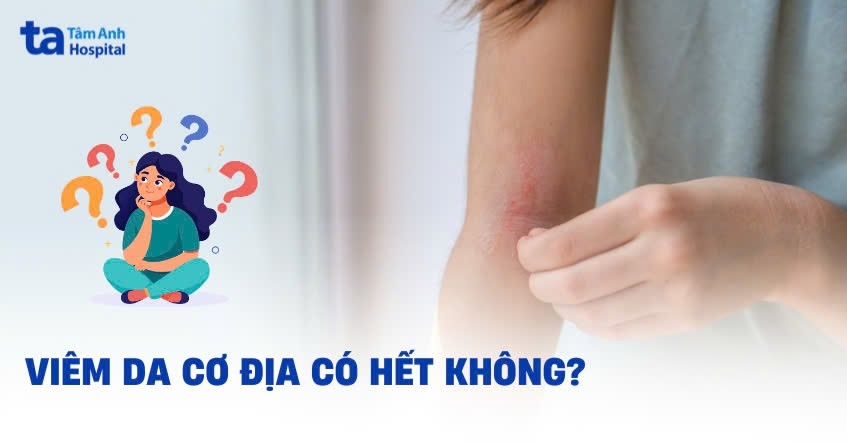 Viêm da cơ địa có hết không? Có chữa khỏi được không? Giải đáp