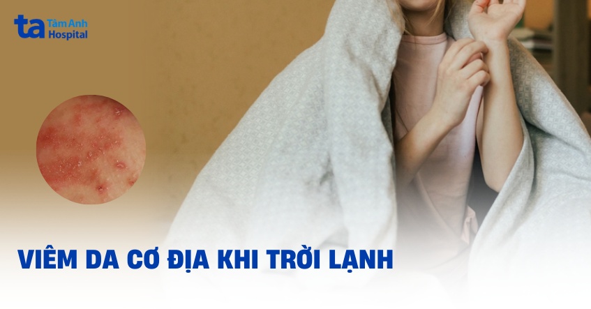 Viêm da cơ địa khi trời lạnh (mùa đông): Nguyên nhân và phòng ngừa