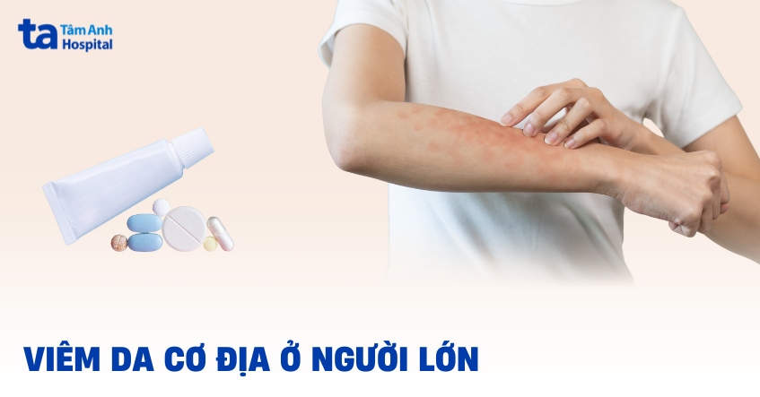 Hình ảnh viêm da cơ địa ở người lớn và những điều cần biết