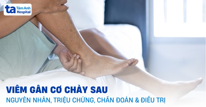 viêm gân cơ chày sau