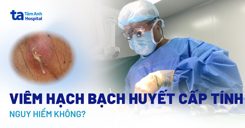 Viêm hạch bạch huyết cấp tính có nguy hiểm không? Ảnh hưởng ra sao?