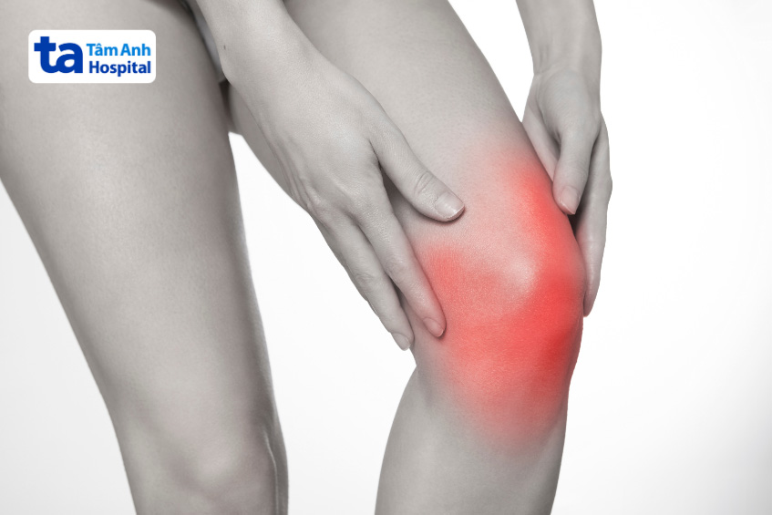 Viêm khớp gối cấp gây đau nhức dữ dội