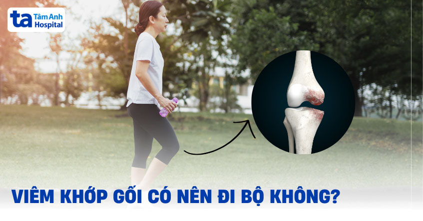 Viêm khớp gối có nên đi bộ không