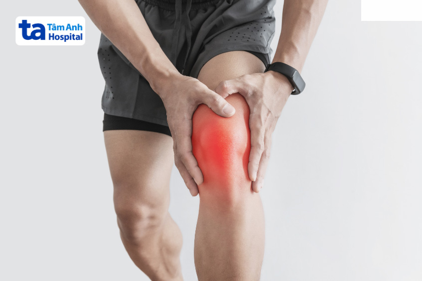 Viêm khớp gối gây đau, sưng, cứng khớp