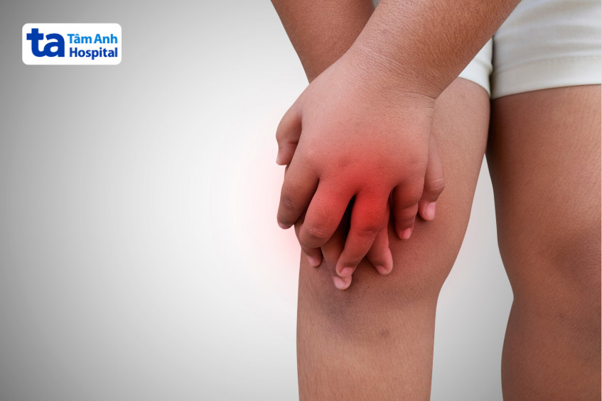 Viêm khớp gối ở trẻ em do nhiều nguyên nhân