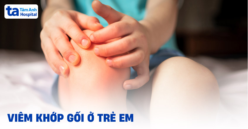 Viêm khớp gối ở trẻ em