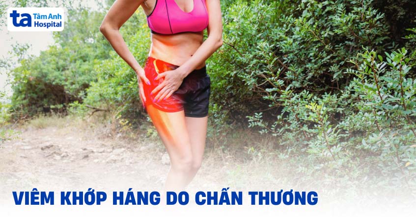 Viêm khớp háng do chấn thương: Cách phòng ngừa và điều trị