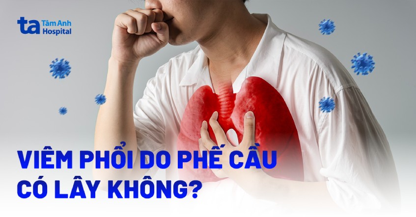 Viêm phổi do phế cầu có lây không? Lây qua đường nào?