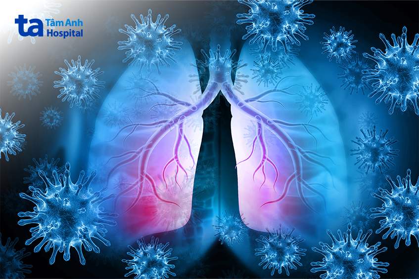 viêm phổi là biến chứng sởi