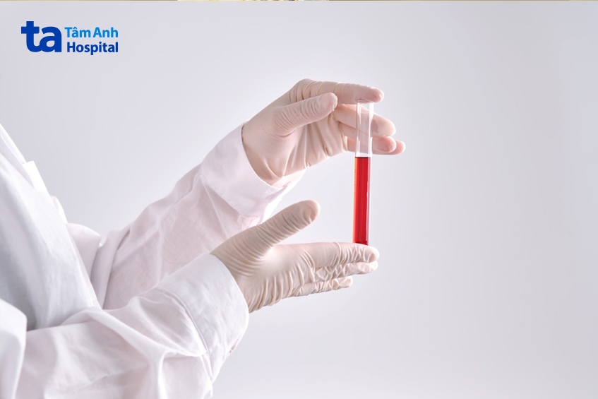 xét nghiệm máu chẩn đoán chức năng