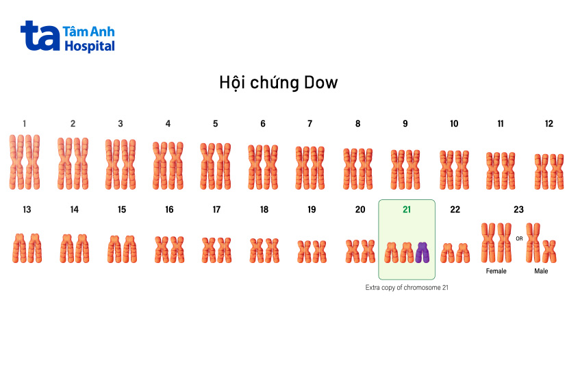 Xét nghiệm NIPT giúp phát hiện ra những bất thường về nhiễm sắc thể của thai nhi một cách chính xác