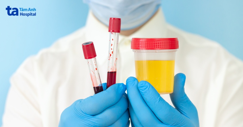 xét nghiệm nước tiểu hoặc xét nghiệm máu