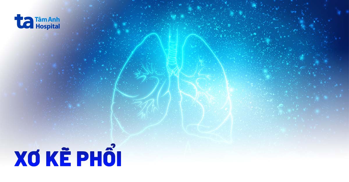 Xơ kẽ phổi: Nguyên nhân, triệu chứng và cách điều trị