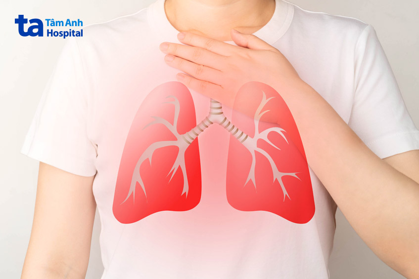 xơ phổi sau lao do vi khuẩn lao