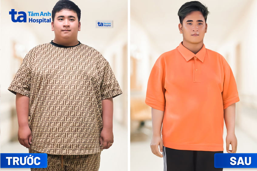 Anh Trần Nhựt Quang trước và sau giảm cân