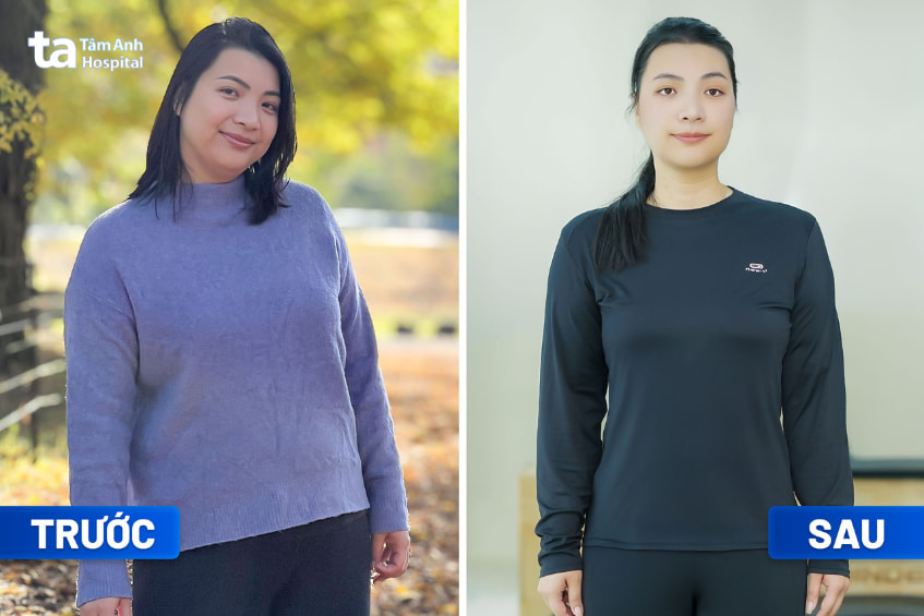 Chị Trần Phương Cẩm Hà giảm cân thành công khi đến Tâm Anh