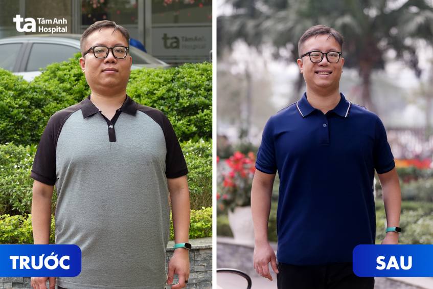 anh quang hải giảm mỡ bụng lâu năm