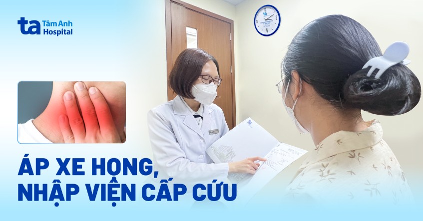 áp xe họng nhập viện cấp cứu