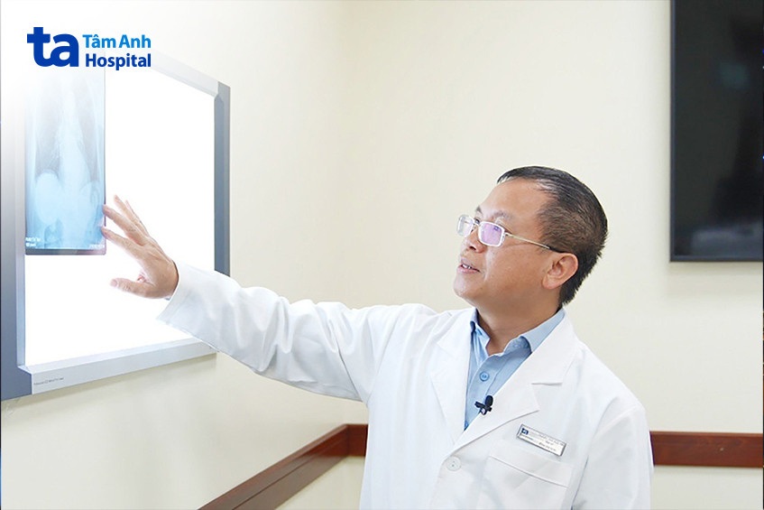 bác sĩ nghiên cứu phim chụp phổi của bệnh nhân