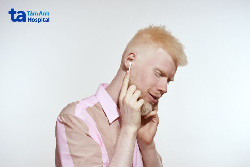 bạch tạng OCA2 có màu tóc từ vàng nhạt đến nâu