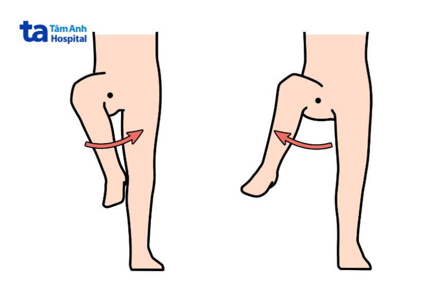 Bài tập viêm khớp háng