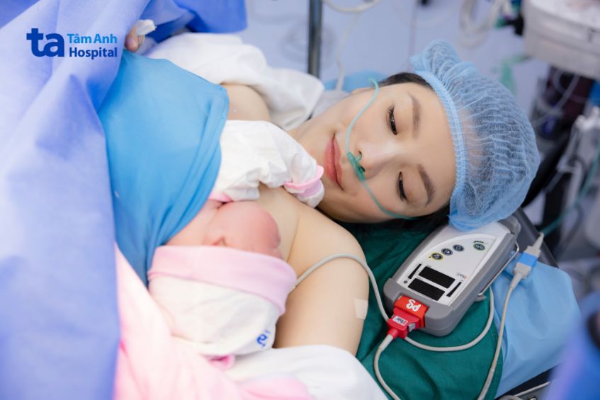 Bé được da kề da với mẹ trong một ca sinh mổ tại Trung tâm Sản Phụ khoa Hệ thống Bệnh viện Đa khoa Tâm Anh