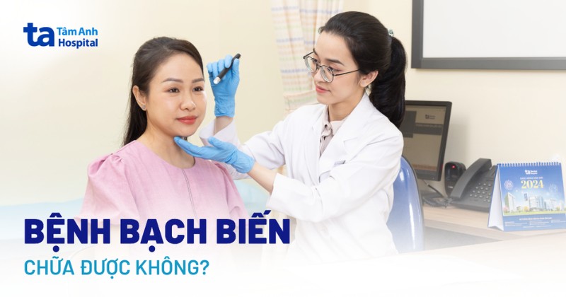 Bệnh bạch biến có chữa được không? Có dễ bị tái phát?