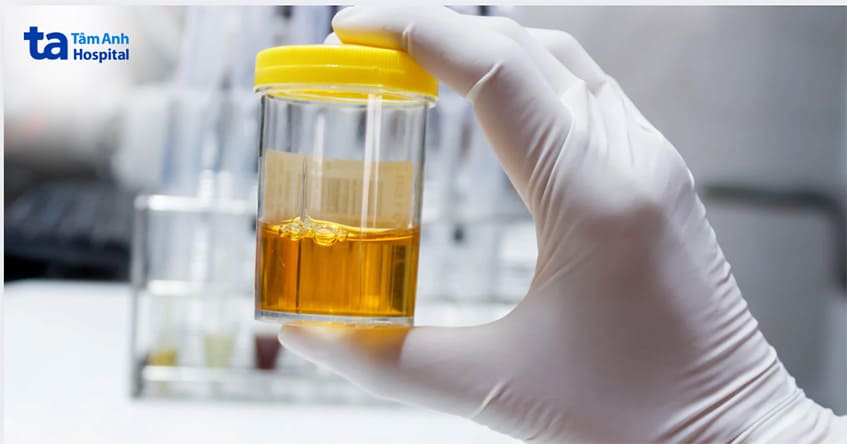 bí tiểu khi mang thai được chẩn đoán theo nhiều cách khác nhau