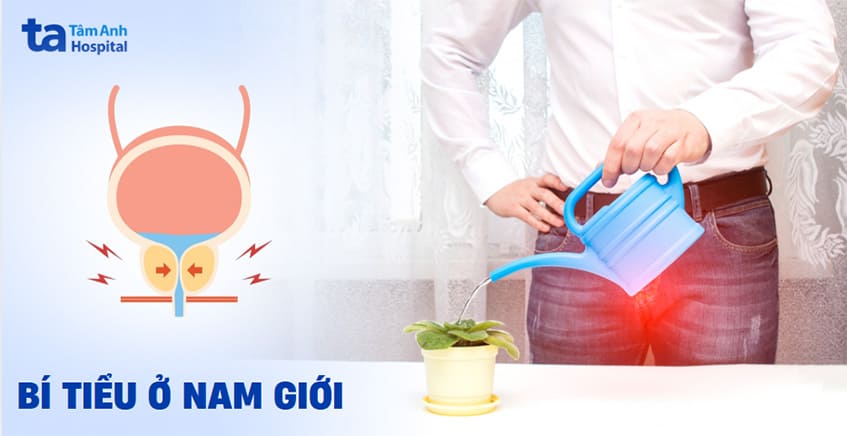 Bí tiểu ở nam giới: Nguyên nhân, biến chứng và cách điều trị