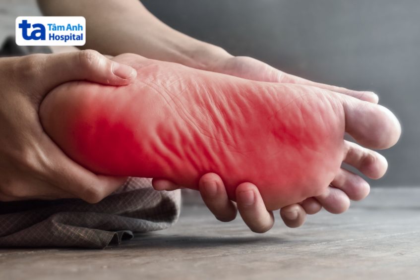 Biến chứng đau thần kinh tọa