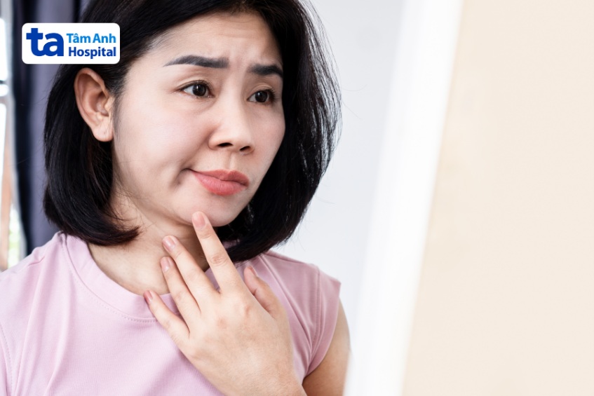 biểu hiện yếu cơ liệt mặc do cpa