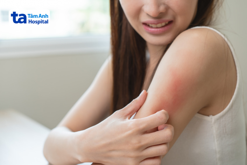 Chống chỉ định Bismuth Subsalicylate