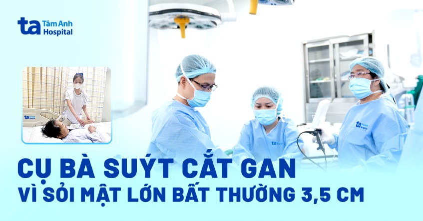 ca bệnh lấy sỏi