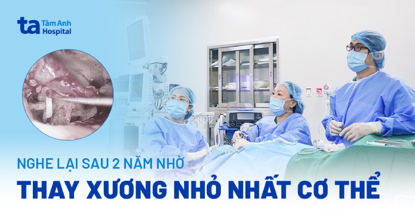 ca thay xương nhỏ