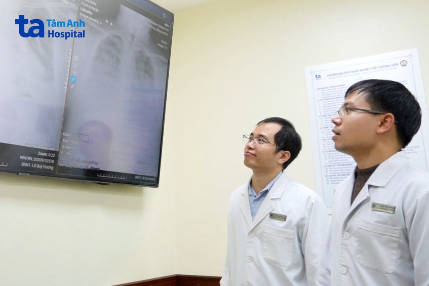 các bác sĩ nghiên cứu phim chụp phổi của người bệnh