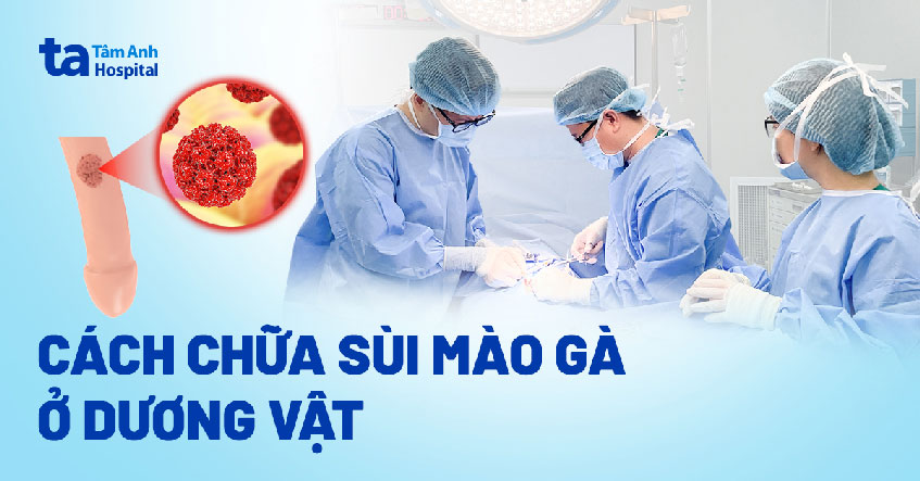 cách chữa sùi mào gà ở dương vật